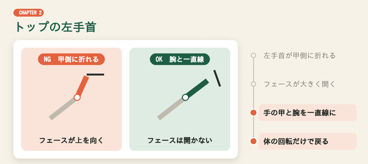 トップの左手首